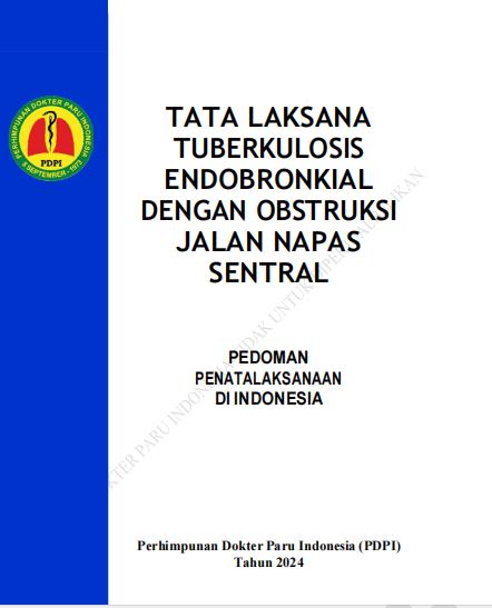tata laksana tuberkulosis endobronkial dengan obstruksi jalan napas sentral 2024 cover