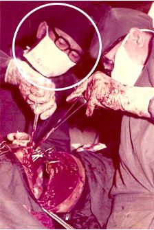 Sejarah Bedah Torak sejarah bedah torak