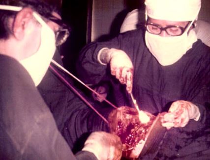 Sejarah Bedah Torak thoractomy under local anaesthesia 24